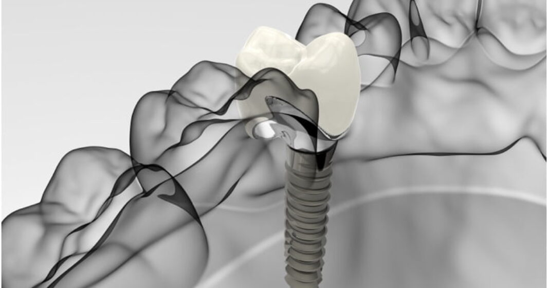 Denmark Street Dental