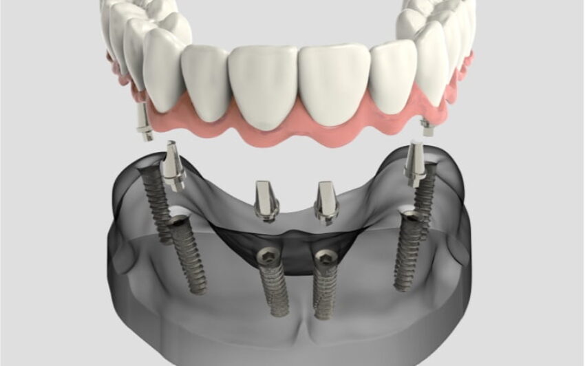 Denmark Street Dental