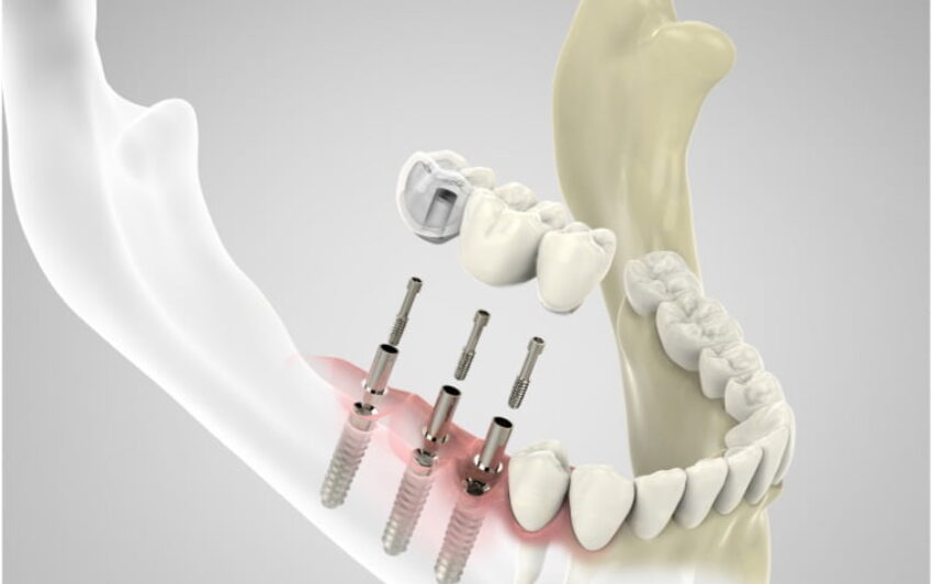 Denmark Street Dental